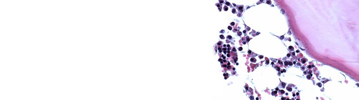 Dry dyes & dye mixtures