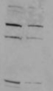 ReBlot™ Antibody Stripping Solution