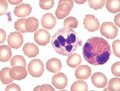 Hemacolor Rapid Staining