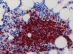 Bone marrow decalcificated with OSTEOSOFT®
