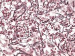 Paraffin section, lung, Reticulin silver plating with nuclear fast red