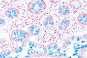 Merck-JP:/01_JP_Image/JP_FreeStyle/JP_LE/JP_LE-LC-Micrscopy/JP_LE-LC-MS-alician_blue_staining/C_ALblue_177x119.jpg