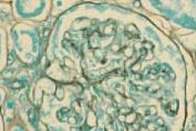 Merck-JP:/01_JP_Image/JP_FreeStyle/JP_LE/JP_LE-LC-Micrscopy/JP_LE-LC-MS-pam_staining/PAM_Staining_177X119.jpg