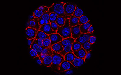 Flourescent cell cluster