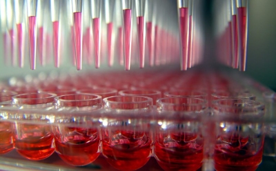 Functional Genomics Screening Functional Genomics Screening