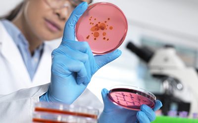 Microbial bioburden and water testing Lab worker inspecting culture disk
