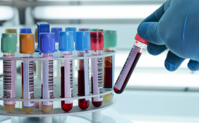 Blood samples fill a laboratory centrifuge A gloved hand places a test tube holding a blood sample into a plastic laboratory test tube rack holding other blood samples with various colored lids.