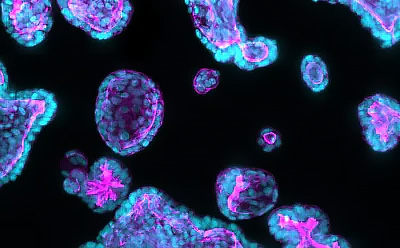 Patient-Derived HUB Organoids for Preclinical Research Fluorescent microscopic image showing colorful cells and cellular structures against a dark background.
