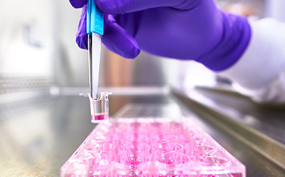 Millicell® cell culture inserts in-use Photograph of a scientist using tweezers to hold a Millicell® hanging cell culture insert.