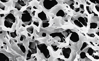 SEM image of a PVDF membrane Scanning electron micrograph image of a PVDF membrane, showing membrane pore structure