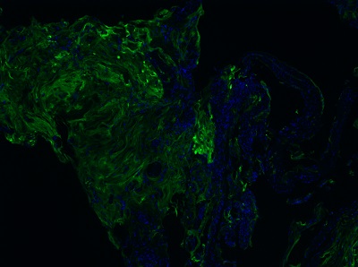 Purified antibodies improve the accuracy of spatial biology research by delivering dependable data on cellular interactions within tissues.