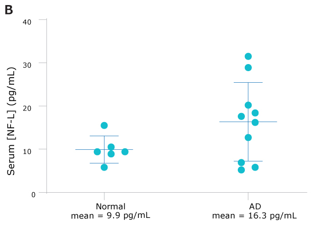NF-L Serum Figure AD(n=10)のNF-L血清濃度は、正常(n=6)サンプルのほぼ2倍を示した。