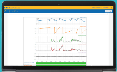 Obtain Steritest Symbio pump parameters to monitor your process Obtain Steritest Symbio pump parameters to monitor your process