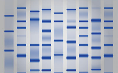 Electrophorèse des protéines et Western Blotting Electrophorèse des protéines et Western Blotting