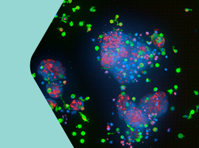 Fluorescence microscopy image showing several colorful organoid clusters with green, blue, and magenta cell signals against a dark background.