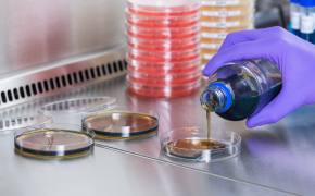 Granulated Raw Materials for Microbial Culture Media Large, brown solvent bottle with Supelco® branded label is opened by a lab worker wearing blue nitrile gloves. Only the hands and lower arms of the worker are shown. One small brown solvent bottle and two small white bottles can be seen in the background.