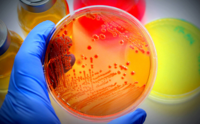 Petri dish with visible bacterial growth