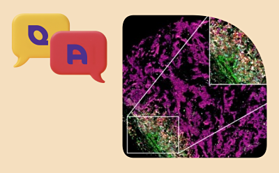 Q &A cover showing an image of spatial biology research beside the letters Q and A on a beige background. Q &A cover showing an image of spatial biology research beside the letters Q and A on a beige background.