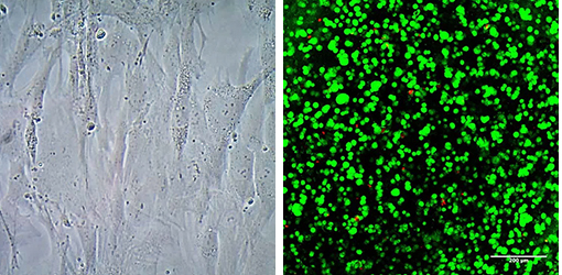 3D culture of human mesenchymal stem cells using PhotoHA®