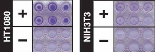 Cell invasion assay Cell invasion assay