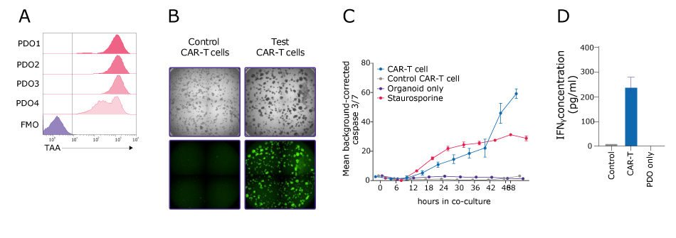 CAR-T cell workflow broken into steps beginning with PDO model selection, moving into imaging based quantification of organoid cell death, and lastly with cytokine analysis.