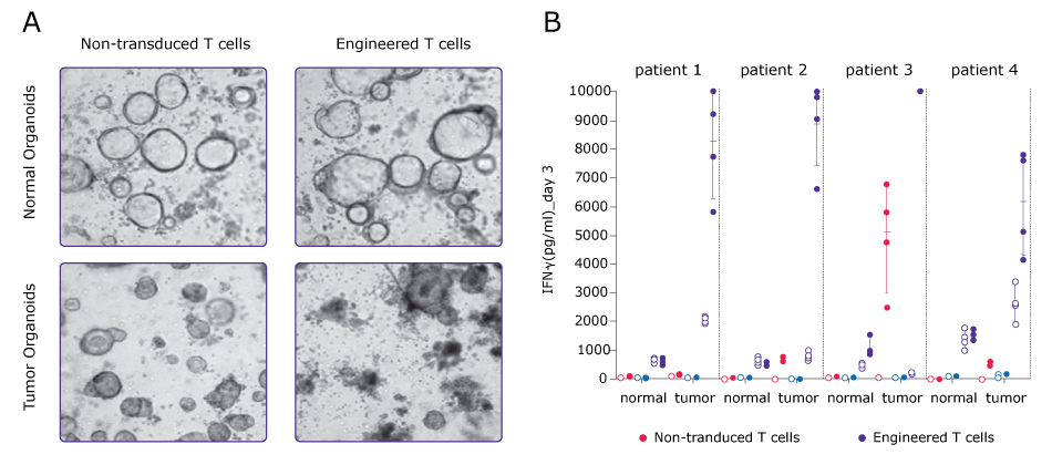 Left, microscopy images of PDO and engineered T cell co-cultures. Right, IFNу activity in PDO cultures in the presence of non-transduced T cells or engineered T cells; the activity is only seen in tumor PDOS with engineered T cells.