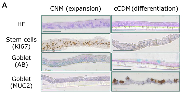 Images of PDO monolayers on inserts IHC images of the cell types for expansion and differentiation.