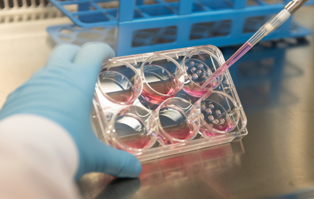 PDO Screen Scientist is pipetting media into the well of a 6 well culture plate that contains ECM domes with organoids.