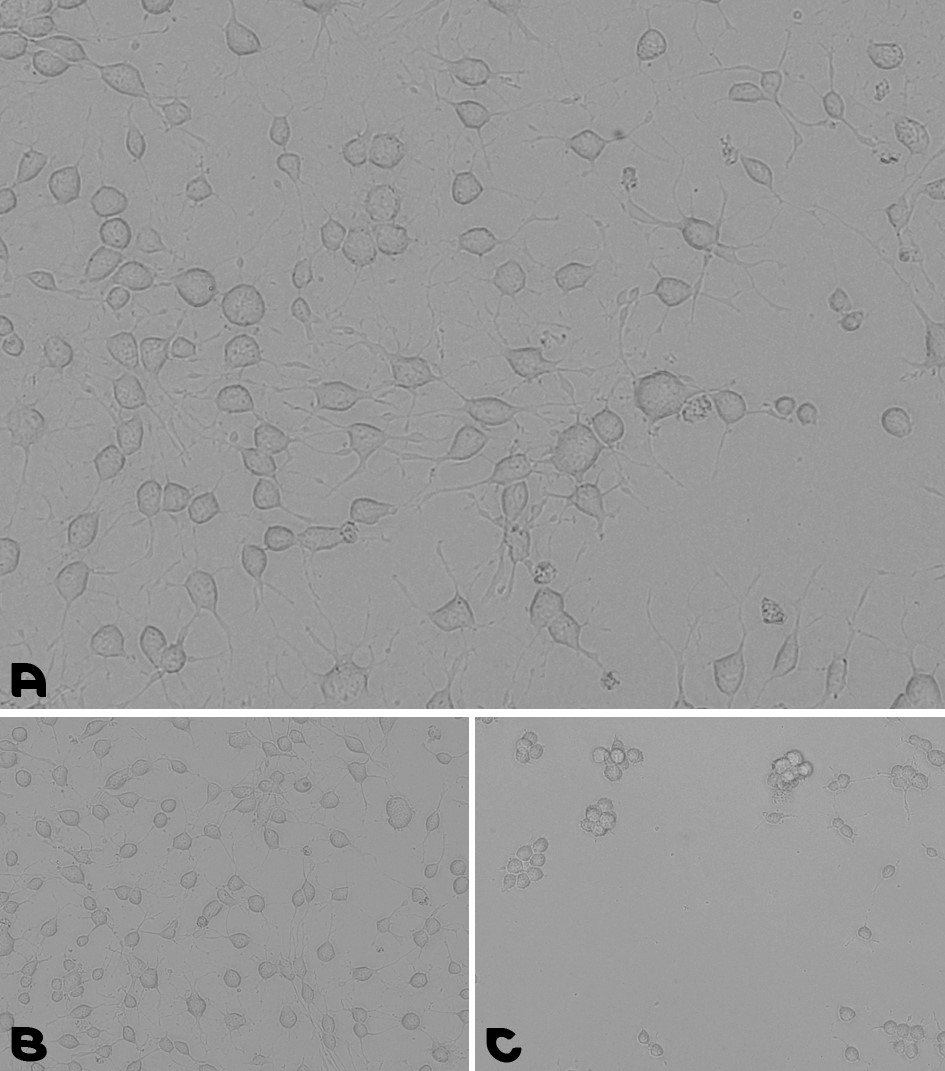 Microscopy images of cell adhesion during a neural stem cells culturing assay Microscopy images of cell adhesion during a neural stem cells culturing assay