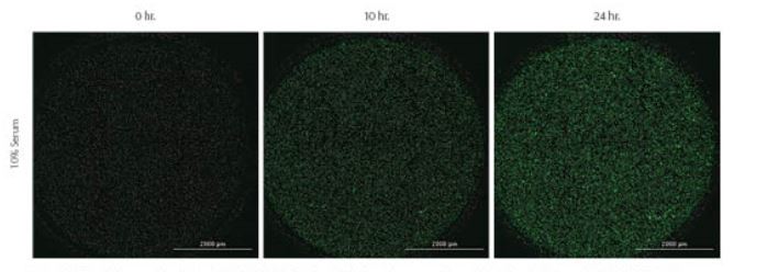 rock-science-Figure-11-Kinetic-images Kinetic images taken of Green-labeled MDA-MB-231 cells labeled prior to experiment with CellTracker™ Green CMFA dye. 10% or 0% serum was used as positive and negative chemoattractant controls, respectively. Images captured using GFP imaging filter cube and a 4X objective.