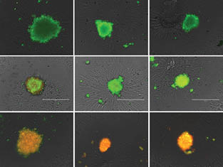rock-science-Figure4-Live-and-dead Live (green) and dead (red) stained 96-hour mono- and co-culture A549 and fibroblast spheroids.
