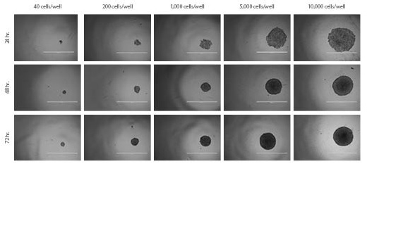 rock-science-Figure2- HT-29-Spheroids HT-29 Spheroids. Spheroid formation and growth of HT-29 spheroids over time with varying seeding densities.
