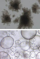 rock-science-rectal-liver Top image features human rectal organoids from a cystic fibrosis cell source cultured for 10 days in Corning Matrigel matrix. Courtesy of MDI Biological Laboratory. Bottom image features Human liver organoids in Corning Matrigel matrix (perm. L.A. Oosterhoff).