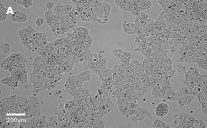 Brightfield imaging of Huh-7D12 cells on Millicell<sup>®</sup> DCI Digital Cell Imager at 10X magnification