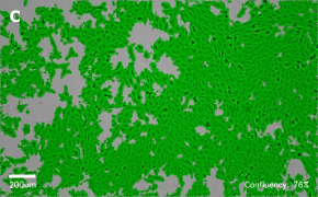 Brightfield imaging of MRC-5 SV2 cells on Millicell<sup>®</sup> DCI Digital Cell Imager at 10X magnification with mask