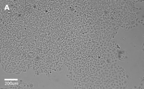 Brightfield imaging of C1008 cells on Millicell<sup>®</sup> DCI Digital Cell Imager at 10X magnification