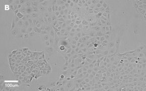 Brightfield imaging of T24T cells on Millicell<sup>®</sup> DCI Digital Cell Imager at 20X magnification