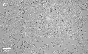 Brightfield imaging of MCF-7 cells on Millicell<sup>®</sup> DCI Digital Cell Imager at 10X magnification