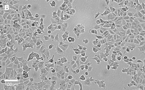 Brightfield imaging of MCF-7 cells on Millicell<sup>®</sup> DCI Digital Cell Imager at 20X magnification