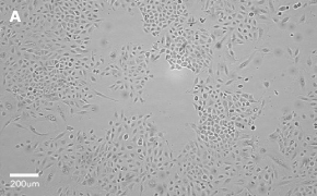 Brightfield imaging of A549 cells on Millicell<sup>®</sup> DCI Digital Cell Imager at 10X magnification