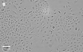 Brightfield imaging of A459 cells on Millicell<sup>®</sup> DCI Digital Cell Imager at 20X magnification