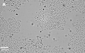 Brightfield imaging of HeLa cells on Millicell<sup>®</sup> DCI Digital Cell Imager at 10X magnification