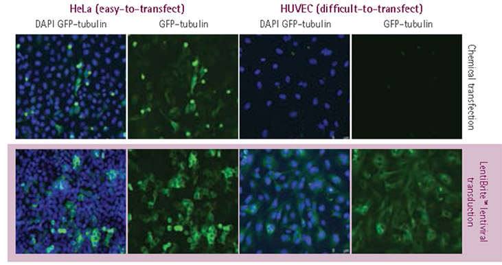 Plasmid vs. lentivirus transfection in easy- and difficult-to-transfect cell types. Plasmid vs. lentivirus transfection in easy- and difficult-to-transfect cell types.