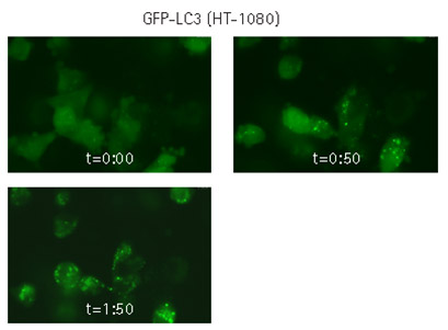 Live cell time-lapse imaging of lentivirally-transduced cells Live cell time-lapse imaging of lentivirally-transduced cells