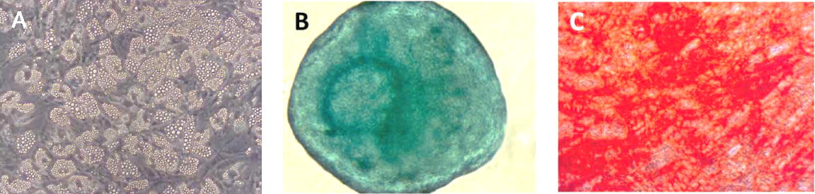 Differentiation of multipotent bone-marrow derived hMSCs into adipocytes, chondrocytes and osteocytes