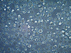 Cell Contamination