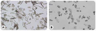 Photomicrographs of isolated cardiomyocytes prepared with freshly purified and ultrafiltered water (A) or stored, ultrapure water without ultrafiltration (B). Many more viable cardiomyocytes were obtained in water A, as shown by their elongated and striated shape. 