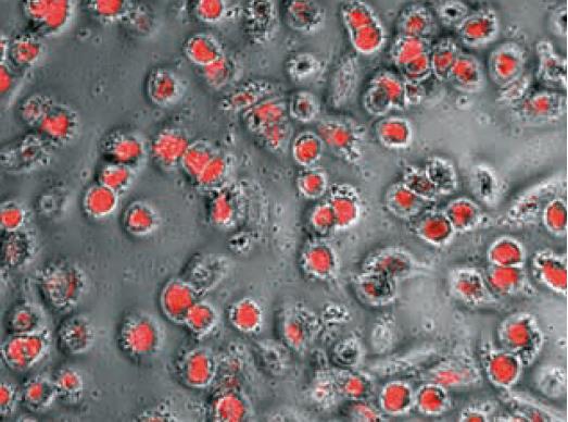 Human Macrophages