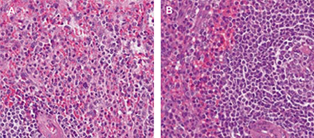 Micrographs of tonsil tissue stained with Hematoxylin and Eosin Micrographs of tonsil tissue stained with Hematoxylin and Eosin