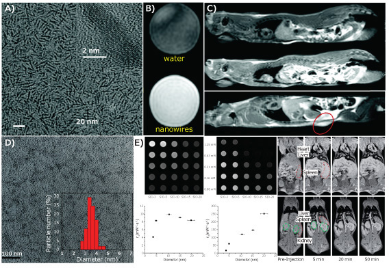 Transmission electron microscopy (TEM) Transmission electron microscopy (TEM)